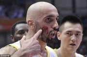 铁肘之下阿巴斯血染赛场 裁判争议判罚引主场震怒